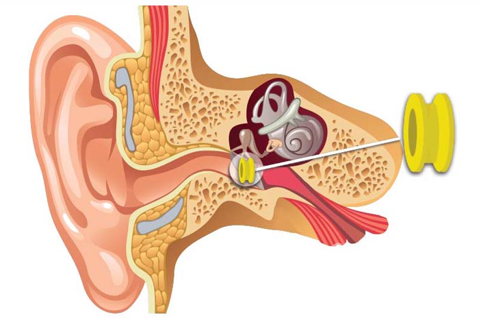 Ear drum surgery in Bangalore