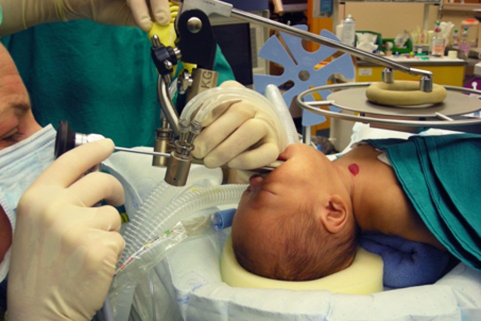 Microscopic voice surgery in Jayanagar