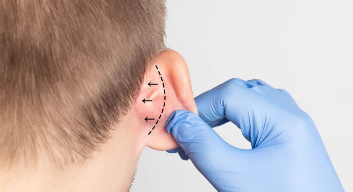Ear reconstructive surgery in Kanakapura Road